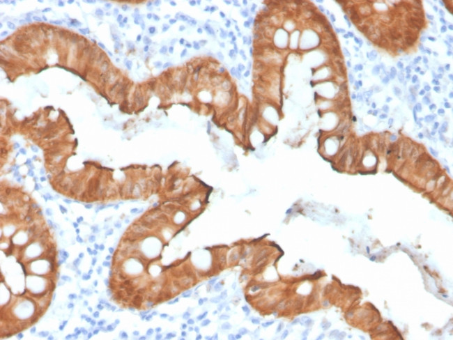 Villin Antibody in Immunohistochemistry (Paraffin) (IHC (P))