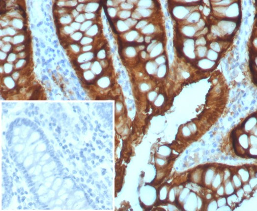 Villin (GI-Mucosal and Urogenital Brush Border Marker) Antibody in Immunohistochemistry (Paraffin) (IHC (P))