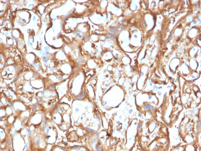 Ezrin/p81 Antibody in Immunohistochemistry (Paraffin) (IHC (P))