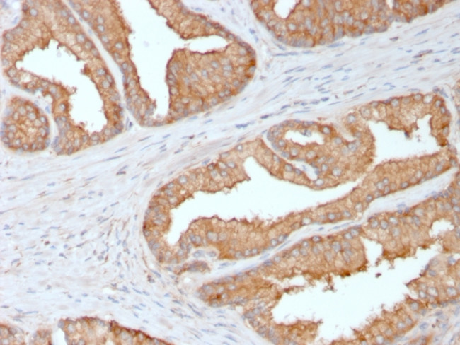 Ezrin/p81 Antibody in Immunohistochemistry (Paraffin) (IHC (P))