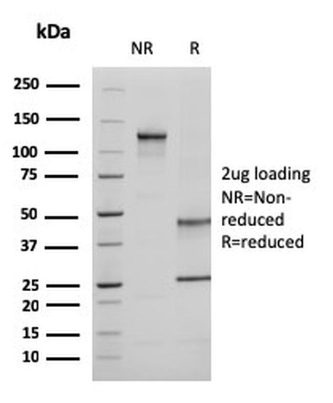 Ezrin/p81 Antibody in SDS-PAGE (SDS-PAGE)