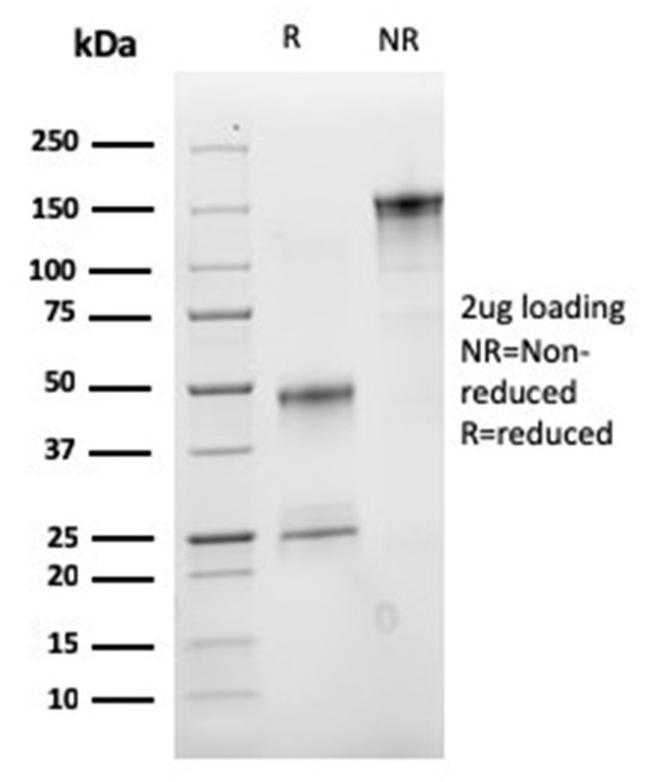 VLDL-Receptor (Very Low Density Lipoprotein Receptor) Antibody in Immunoelectrophoresis (IE)