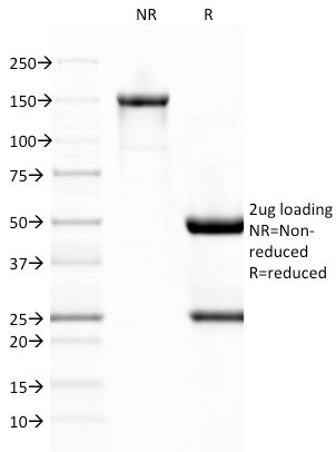 von Willebrand Factor/Factor VIII Related-Ag (Endothelial Marker) Antibody in SDS-PAGE (SDS-PAGE)