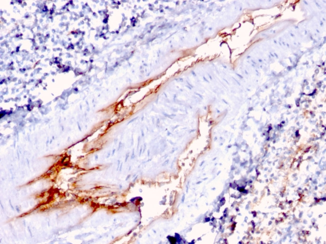 von Willebrand Factor/Factor VIII Related-Ag (Endothelial Marker) Antibody in Immunohistochemistry (Paraffin) (IHC (P))