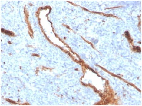 von Willebrand Factor/ Factor VIII Related-Ag (Endothelial Marker) Antibody in Immunohistochemistry (Paraffin) (IHC (P))