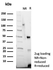 von Willebrand Factor/Factor VIII Related-Ag (Endothelial Marker) Antibody in SDS-PAGE (SDS-PAGE)