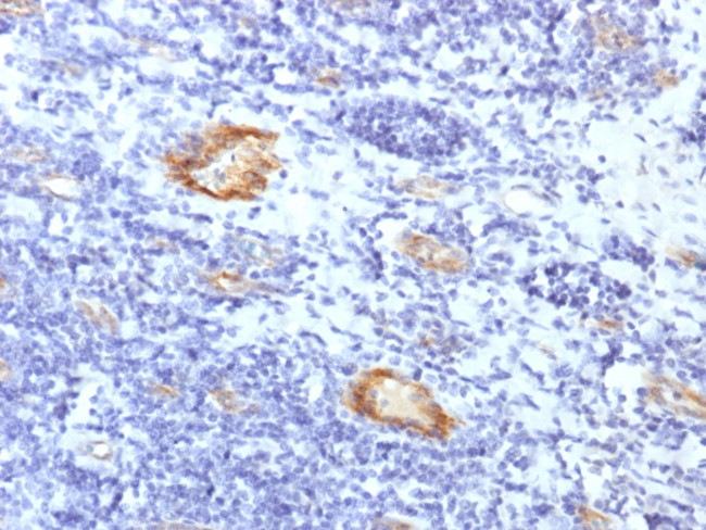 von Willebrand Factor/Factor VIII Related-Ag Antibody in Immunohistochemistry (Paraffin) (IHC (P))