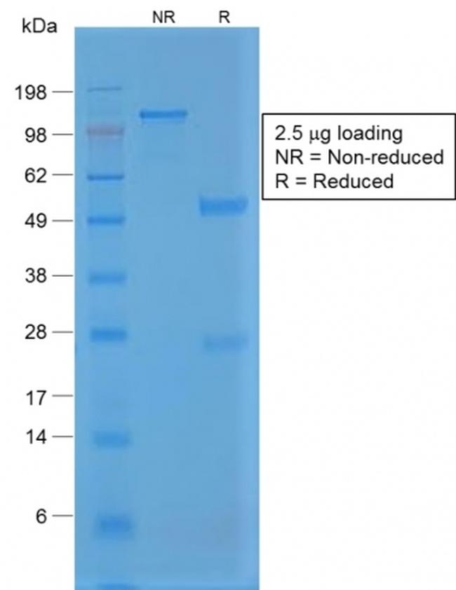 von Willebrand Factor/Factor VIII Related-Ag Antibody in SDS-PAGE (SDS-PAGE)