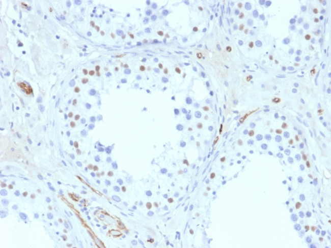 Wilm's Tumor 1 (WT1) (Wilm's Tumor and Mesothelial Marker) Antibody in Immunohistochemistry (Paraffin) (IHC (P))