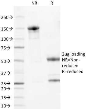 Wilm's Tumor 1 (WT1) (Wilm's Tumor and Mesothelial Marker) Antibody in SDS-PAGE (SDS-PAGE)