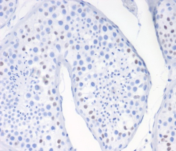 Wilm's Tumor 1 (WT1) (Wilm's Tumor and Mesothelial Marker) Antibody in Immunohistochemistry (Paraffin) (IHC (P))