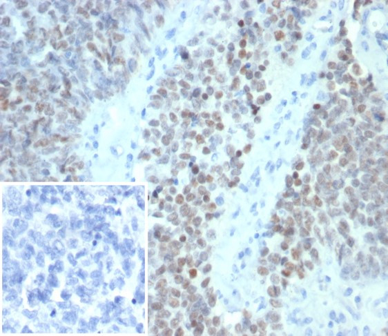 Wilm's Tumor 1 (WT1) (Wilm's Tumor and Mesothelial Marker) Antibody in Immunohistochemistry (Paraffin) (IHC (P))