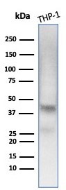 Wilm's Tumor 1 (WT1) (Wilm's Tumor and Mesothelial Marker) Antibody in Western Blot (WB)