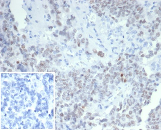 Wilm's Tumor 1 (WT1) (Wilm's Tumor and Mesothelial Marker) Antibody in Immunohistochemistry (Paraffin) (IHC (P))