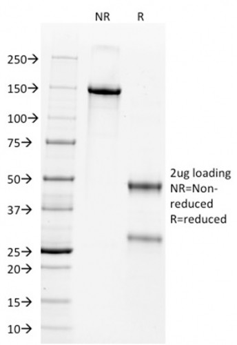 Wilm's Tumor 1 (WT1) (Wilm's Tumor and Mesothelial Marker) Antibody in SDS-PAGE (SDS-PAGE)