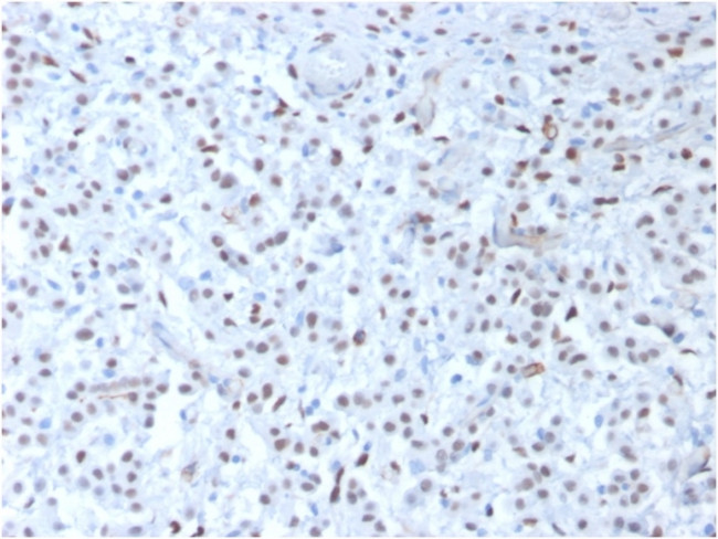 Wilms Tumor 1 (WT1) Antibody in Immunohistochemistry (Paraffin) (IHC (P))