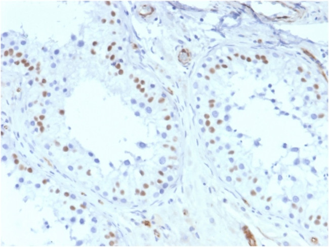 Wilms Tumor 1 (WT1) Antibody in Immunohistochemistry (Paraffin) (IHC (P))