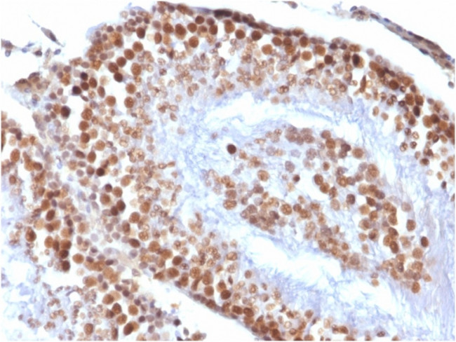 Wilms Tumor 1 (WT1) Antibody in Immunohistochemistry (Paraffin) (IHC (P))