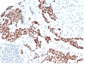 Wilms Tumor 1 (WT1) Antibody in Immunohistochemistry (Paraffin) (IHC (P))