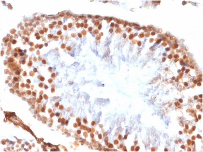 Wilms Tumor 1 (WT1) Antibody in Immunohistochemistry (Paraffin) (IHC (P))