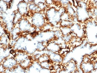 Wilms Tumor 1 (WT1) Antibody in Immunohistochemistry (Paraffin) (IHC (P))