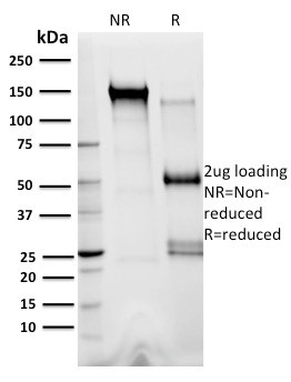 XRCC3 Antibody in SDS-PAGE (SDS-PAGE)