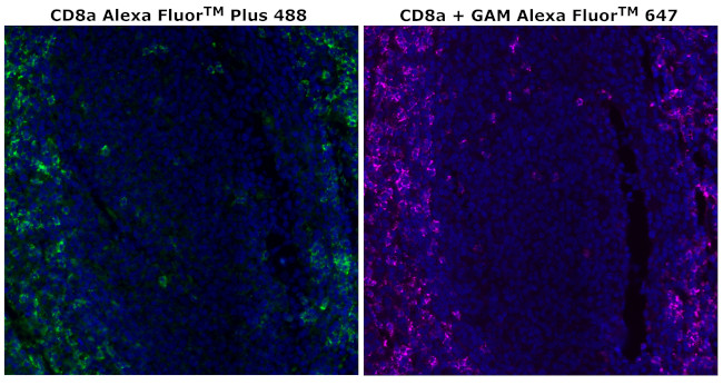 CD8 alpha Antibody in Immunohistochemistry (Paraffin) (IHC (P))