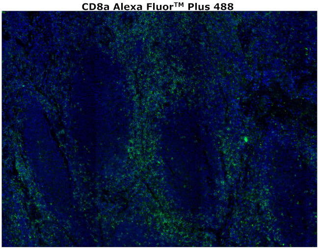 CD8 alpha Antibody in Immunohistochemistry (Paraffin) (IHC (P))