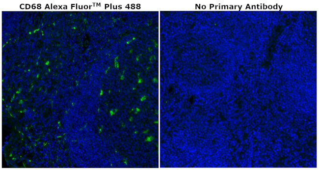 CD68 Antibody in Immunohistochemistry (Paraffin) (IHC (P))