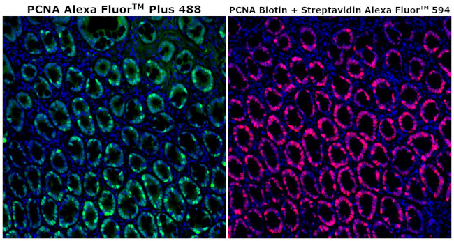 PCNA Antibody in Immunohistochemistry (Paraffin) (IHC (P))