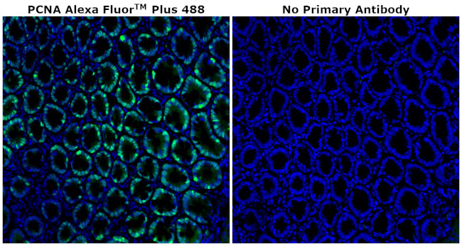 PCNA Antibody in Immunohistochemistry (Paraffin) (IHC (P))