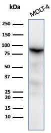 XRCC5 (Ku86/Ku80) (Thyroid-Lupus Autoantigen) Antibody in Western Blot (WB)