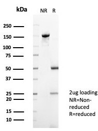 XRCC5 (Ku86/Ku80) (Thyroid-Lupus Autoantigen) Antibody in SDS-PAGE (SDS-PAGE)