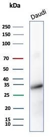 YY1 (Transcription Factor) Antibody in Western Blot (WB)