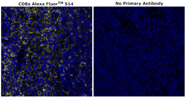 CD8 alpha Antibody in Immunohistochemistry (Paraffin) (IHC (P))