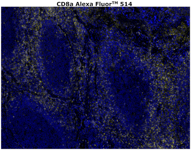 CD8 alpha Antibody in Immunohistochemistry (Paraffin) (IHC (P))