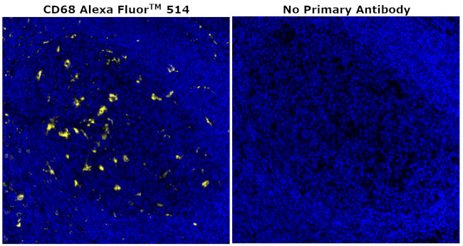 CD68 Antibody in Immunohistochemistry (Paraffin) (IHC (P))