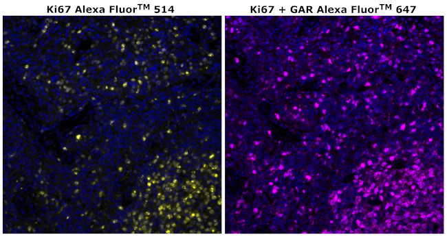 Ki-67 Antibody in Immunohistochemistry (Paraffin) (IHC (P))