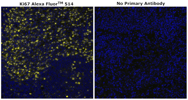 Ki-67 Antibody in Immunohistochemistry (Paraffin) (IHC (P))