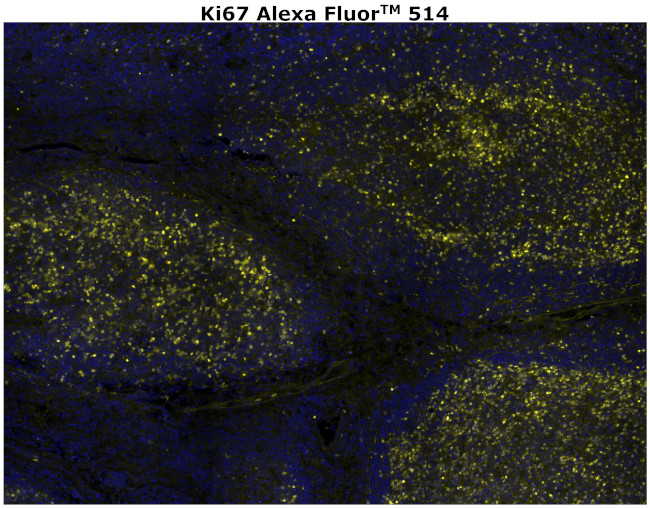 Ki-67 Antibody in Immunohistochemistry (Paraffin) (IHC (P))