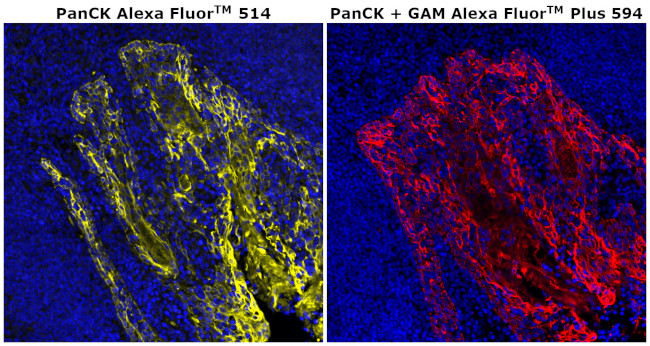 Pan Cytokeratin Antibody in Immunohistochemistry (Paraffin) (IHC (P))