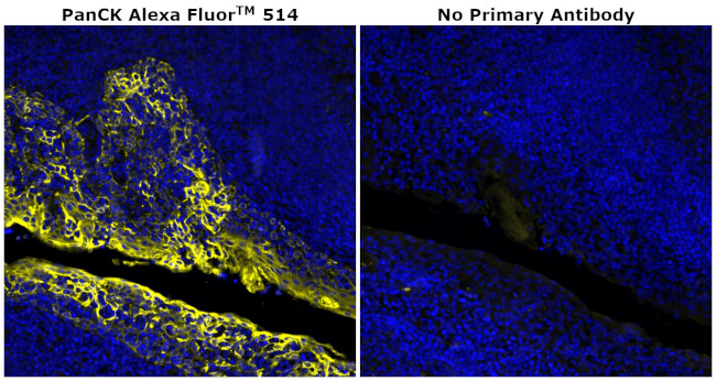 Pan Cytokeratin Antibody in Immunohistochemistry (Paraffin) (IHC (P))