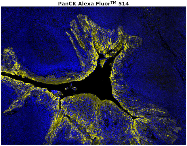 Pan Cytokeratin Antibody in Immunohistochemistry (Paraffin) (IHC (P))