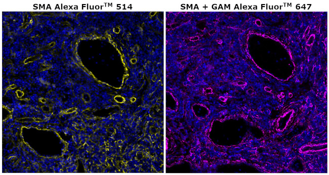 Alpha-Smooth Muscle Actin Antibody in Immunohistochemistry (Paraffin) (IHC (P))