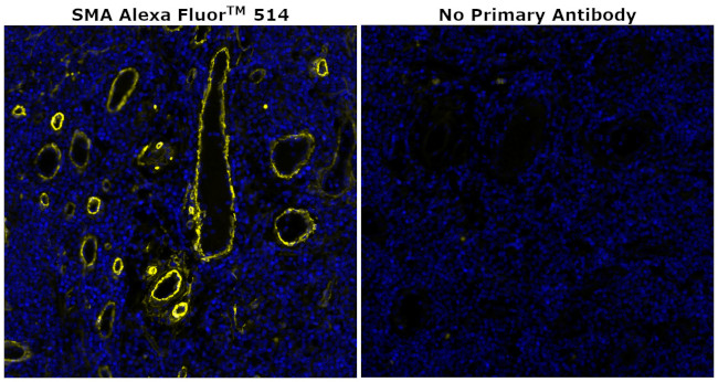 Alpha-Smooth Muscle Actin Antibody in Immunohistochemistry (Paraffin) (IHC (P))