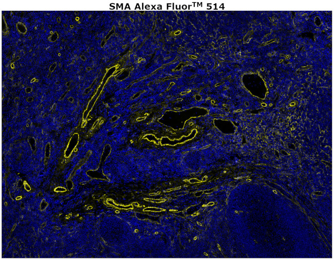 Alpha-Smooth Muscle Actin Antibody in Immunohistochemistry (Paraffin) (IHC (P))