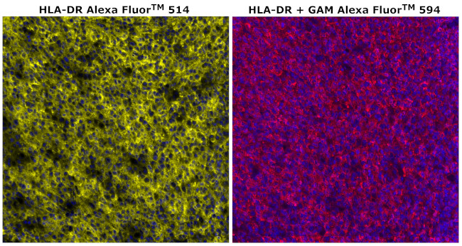 HLA-DR Antibody in Immunohistochemistry (Paraffin) (IHC (P))