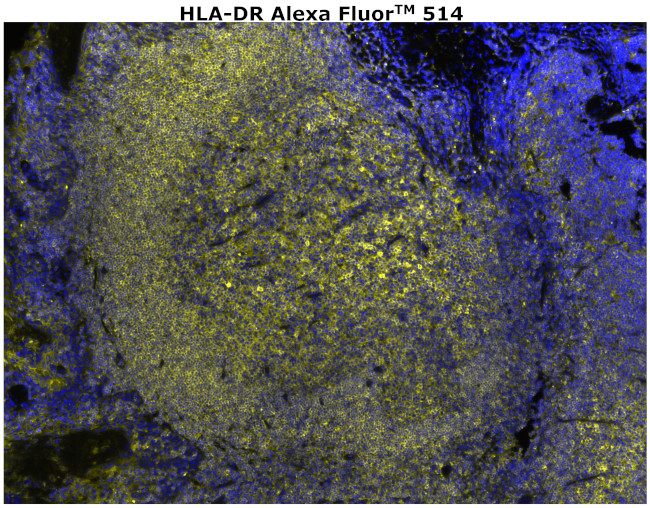 HLA-DR Antibody in Immunohistochemistry (Paraffin) (IHC (P))