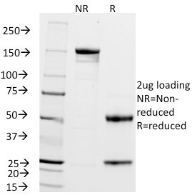 ZAP70 (Chronic Lymphocytic Leukemia Marker) Antibody in SDS-PAGE (SDS-PAGE)