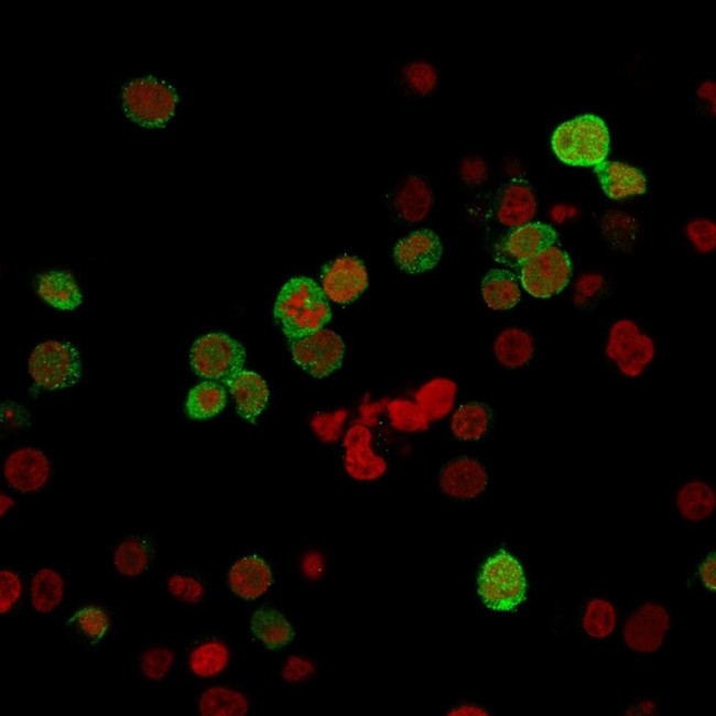 ZAP70 Antibody in Immunocytochemistry (ICC/IF)